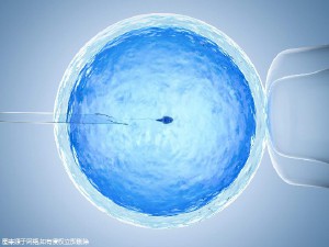 卵子凍結保存